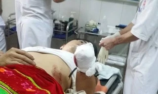 Anh Ngọc đang được điều trị tại bệnh viện.