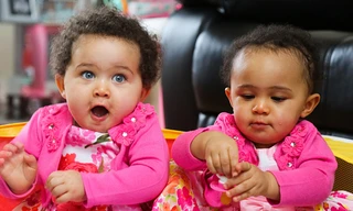 Amelia và Jasmine không giống nhau như các cặp song sinh cùng trứng thông thường.