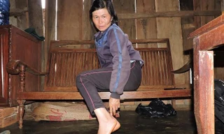 Vết thương ở gót chân của nạn nhân.