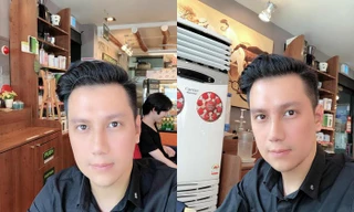 Sau ly hôn, Việt Anh khoe mặt khác lạ do phẫu thuật thẩm mỹ