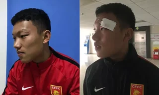 Cầu thủ Hà Nội đấm vào mặt đối thủ người Trung Quốc