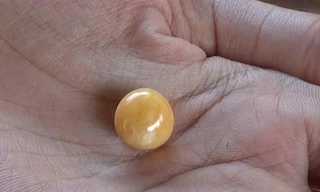 Người phụ nữ ‘không xu dính túi’ tìm thấy ngọc trai vàng cực quý hiếm