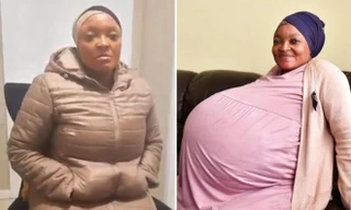 Sithole trước (ảnh phải) và sau khi sinh con (ảnh trái). 