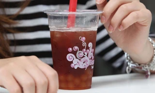 Loại bỏ 300 viên sỏi thận từ cô gái trẻ uống trà sữa thay nước