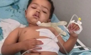 Một em bé bị thương sau vụ không kích. Ảnh: Reuters