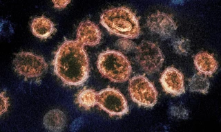 Virus SARS-CoV-2 - một loại virus corona gây bệnh COVID-19. Ảnh: CNN