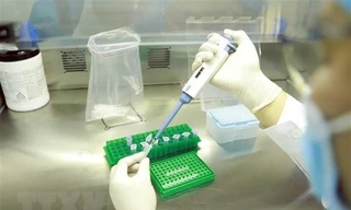 Kết luận thanh tra mua sắm trang thiết bị, vật tư y tế tại Bình Phước