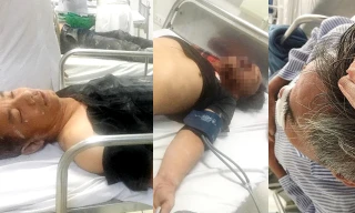 Đánh 3 người trọng thương rồi gọi Công an đến... bắt trộm