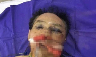 Nguyên đại tá công an bị khởi tố vì đánh anh trai, chị dâu nhập viện