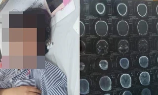 Cơ quan chức năng Quảng Ninh nói gì vụ nữ sinh bị đánh hội đồng?