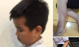 Đình chỉ 6 tháng cô giáo Hải Phòng đánh học sinh giữa lớp