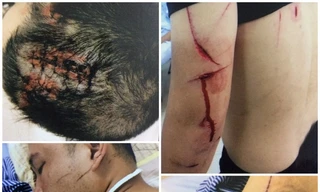 Hải Phòng: 'cát tặc' chém trọng thương chủ đầm tôm vì dám ngăn cản