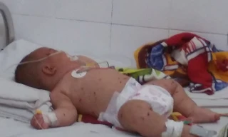 Bệnh nhi L.A.P đang được theo dõi điều trị tại bệnh viện.