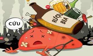 Các tác nhân gây hại cho gan.