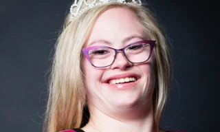 Mắc bệnh Down vẫn đăng quang hoa hậu