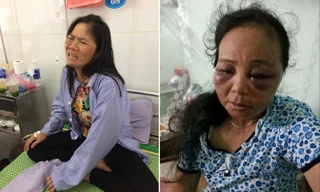 Hai người phụ nữ bị đánh do người dân hiểu nhầm.