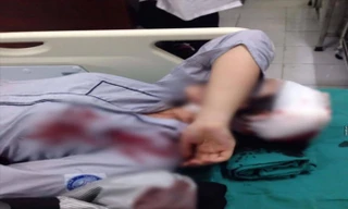 Nữ sinh bị đánh nhập viện xuất phát từ mâu thuẫn “nhìn đểu”.