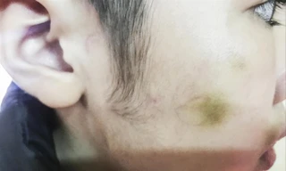 Bạo hành trẻ em: Bỏ ngay tư tưởng 'yêu cho roi cho vọt'