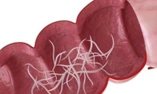 Ảnh minh họa: Internet