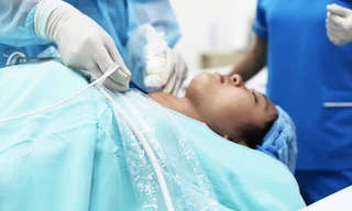 Mù mắt vì bỏ điều trị bướu cổ