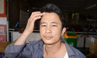 Anh Lê Duy Trọng và những vết thương trên cổ. Ảnh: Tuấn Nguyễn
