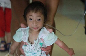 Cô bé tý hon ở Trung Quốc