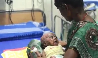 Kỳ lạ chuyện bé 3 tháng tuổi tự phát hỏa