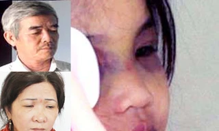 Khởi tố cặp vợ chồng bạo hành con nuôi