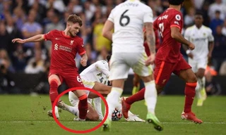 Tài năng trẻ Liverpool xuất viện sau chấn thương kinh hoàng