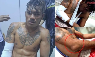 Võ sĩ số 1 Campuchia bị cao thủ Thái Lan đánh gãy tay, đau đớn xin hàng 