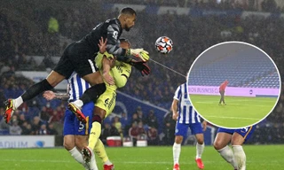 Cầu thủ Arsenal ở lại sân cả tối để tìm chiếc răng bị rơi