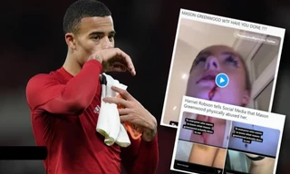 Sao trẻ MU đánh đập dã man bạn gái vì không được quan hệ