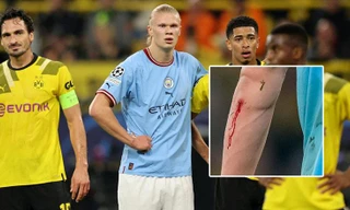 Vì sao HLV Man City vội vàng rút Haaland ra khỏi sân trong trận gặp Dortmund? 