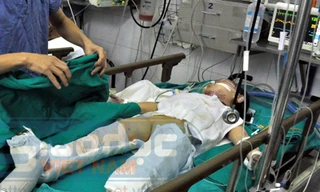 Sức khỏe cháu bé vụ nổ xe máy tiến triển tốt hơn