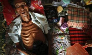 Xót xa những mảnh đời tiều tụy vì AIDS