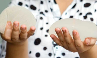 Mẹ nâng ngực, con có bú nhầm... silicon?