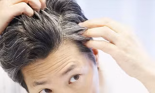 Tóc bạc sớm