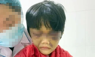 Cháu V.N.P.C tại Bệnh viện Đa khoa tỉnh Hải Dương.