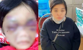 Điều tra vụ bé gái 6 tuổi ở Hải Dương bị mẹ bạo hành phải nhập viện
