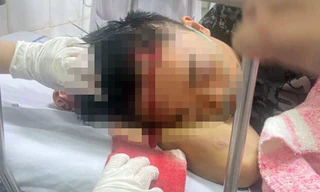 Tạm giữ 14 đối tượng vụ hai nhóm trai làng ở Hải Phòng hỗn chiến