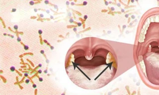 Ảnh minh họa: Internet 