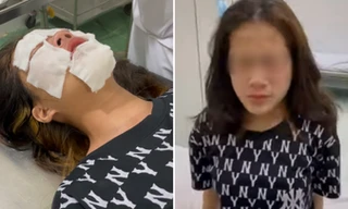 Nữ sinh phải vào viện tâm thần điều trị sau khi bị chọc ghẹo, xịt hơi cay bỏng mặt 