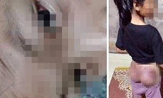 Công an viên đánh bé gái 12 tuổi tím người vì nghi trộm 50.000 đồng