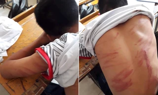 Người bố khai lý do đánh con ngất xỉu phải nhập viện