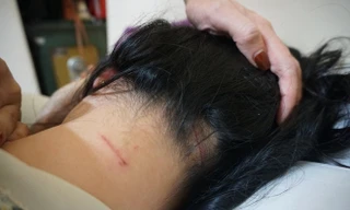 Chị Trang được đưa đi giám định với tỷ lệ thương tật 12%.