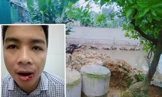 Thầy giáo nóng nảy phi tuýp sắt vỡ xương hàm hàng xóm 
