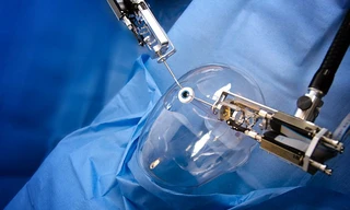 Phẫu thuật mắt nhờ người máy Axsis có cánh tay chỉ rộng 1,8mm 