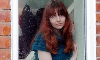 Kỳ lạ người bị dị ứng nước mưa, nước bọt, mồ hôi