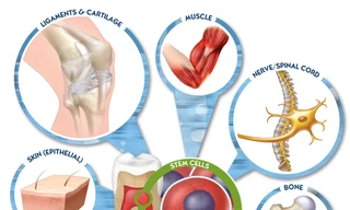 Dùng tế bào gốc có thể chữa được những bệnh gì?