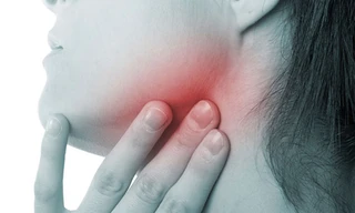 Cần biết điều này khi vùng cổ bỗng nổi u